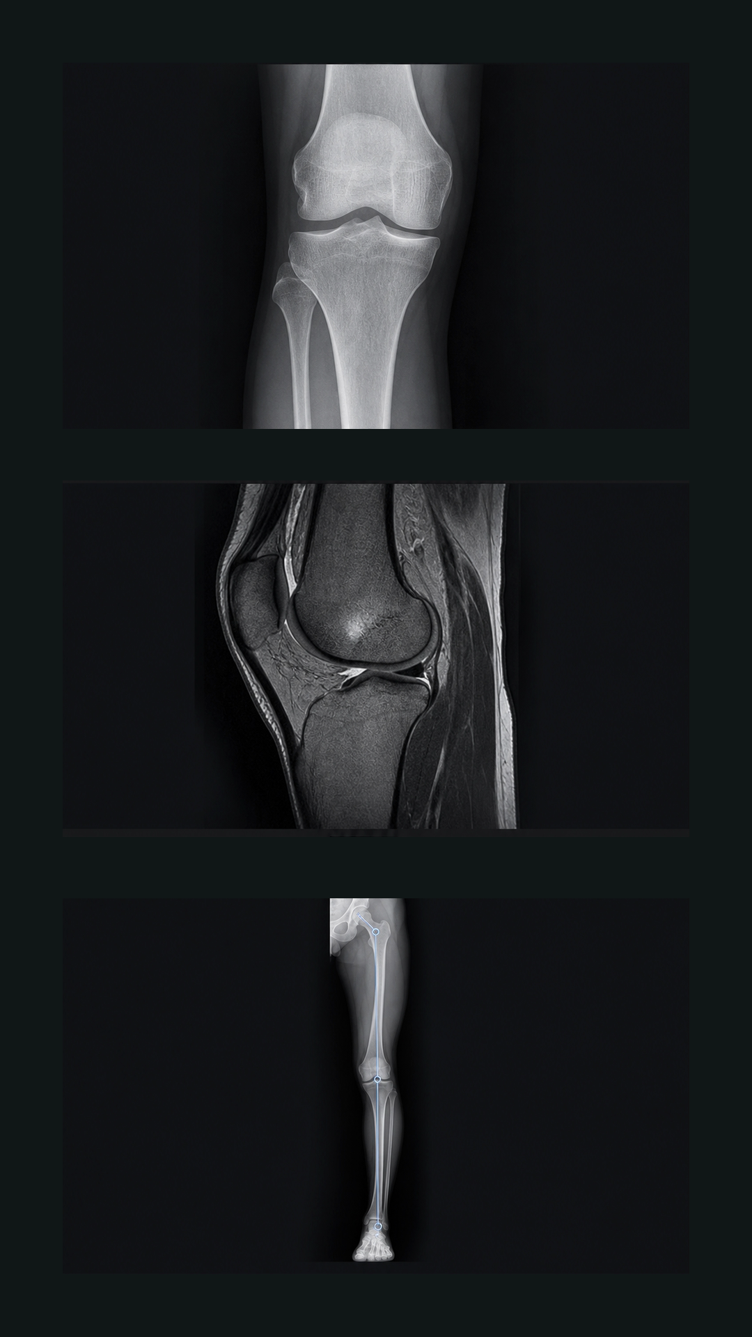 ภาพประกอบแนวคิดที่แยกแสดงเอกซเรย์ MRI และแนวแกนขา