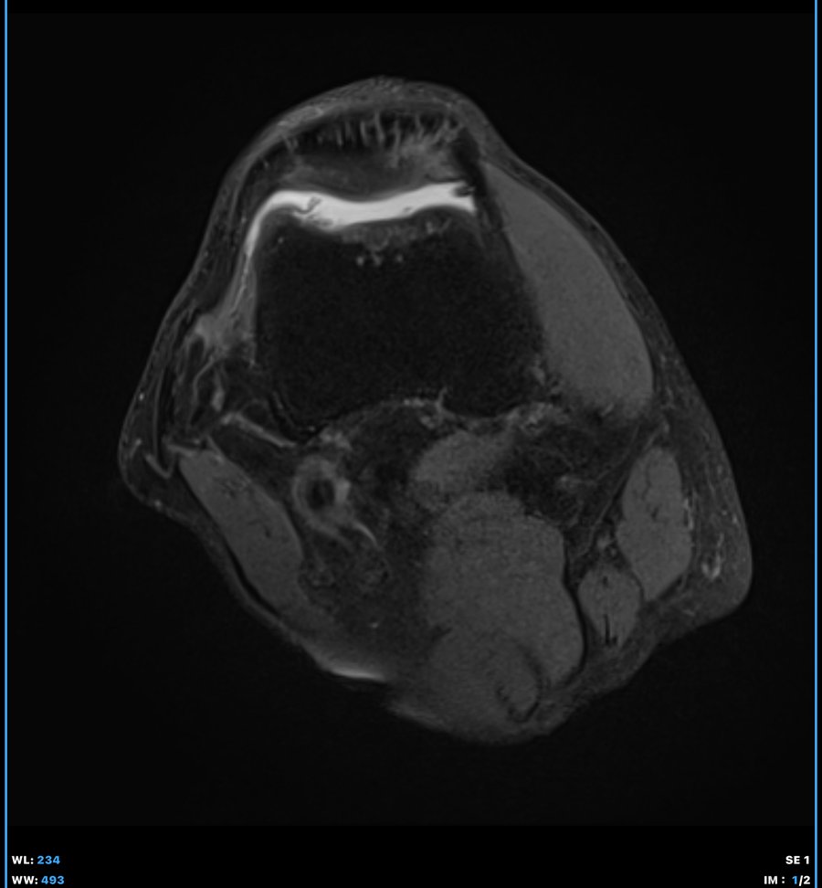 3T 膝 MRI 適格性評估 — Cellforce One Clinic Tokyo
